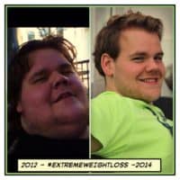 Torsten Prix Extremeweightloss